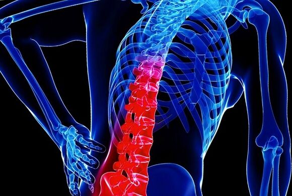 Reasons -Development of thoracic osteochondrosis