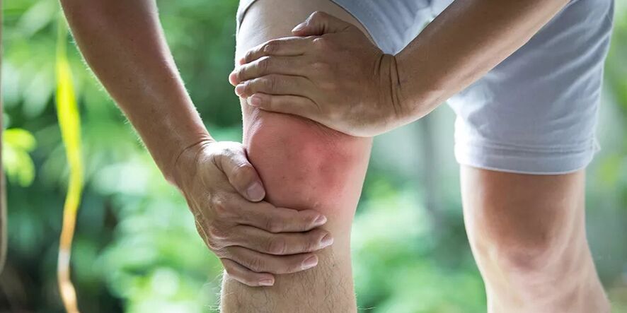 Severe pain during physical activity due to knee joint arthrosis